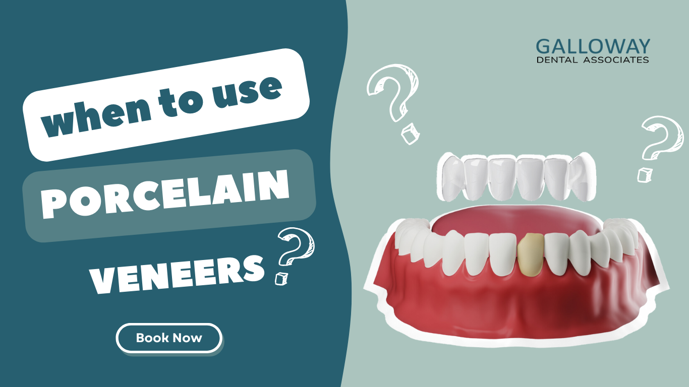 When to use Porcelain Veneers In Miami, FL